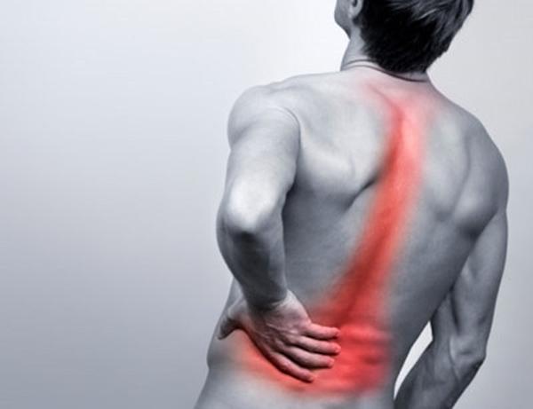 Nguyên nhân gây đau cơ lưng